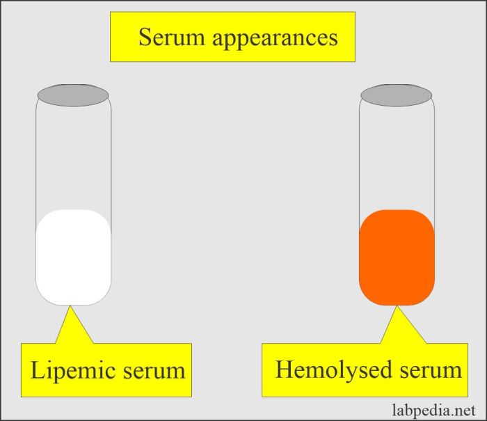 Knowledge drill 9 7 serum appearance